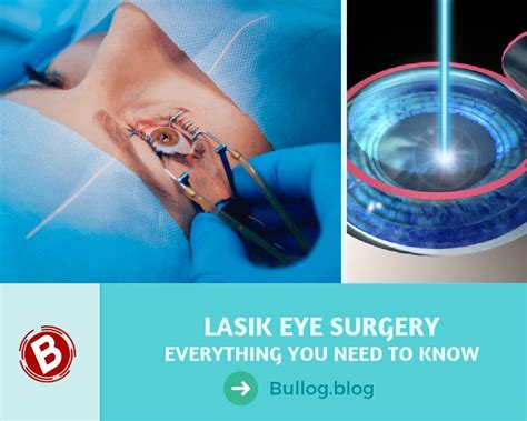 lasik eye surgery las vegas|benefits and risks of lasik eye surgery.